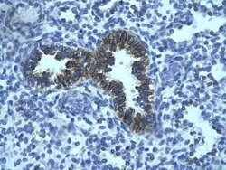 PHF16 Rabbit anti-Human, Polyclonal, Novus Biologicals:Antibodies:Primary